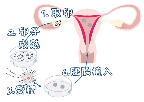 遗传咨询专家